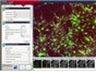 Image: Molecular Devices Introduces MetaXpress 5.0 High Content Image Acquisition and Analysis Software
