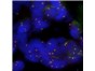 Image: OGT expands Cytocell sarcoma FISH probe range