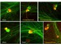 Image: High-Quality Dorsal Root Ganglion Neurons for Research