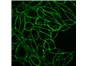 Image: CellBrite™ Fix: Fixable membrane dyes for live cells